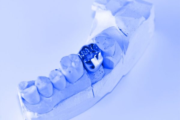 Dental-Crown-2.jpg